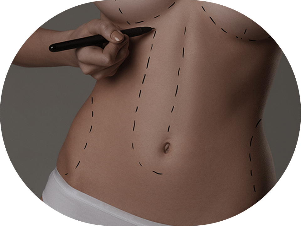 Estetică și chirurgie plastică